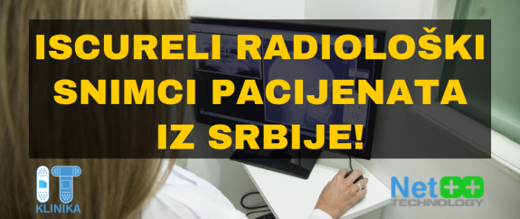 Iscureli radiološki snimci pacijenata iz Srbije! Iscureli radiološki snimci pacijenata iz Srbije!